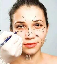 爆料整形诱导案例最新,最新案例警示录  第3张 爆料整形诱导案例最新,最新案例警示录  第3张